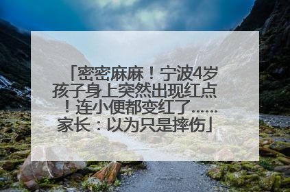 密密麻麻！宁波4岁孩子身上突然出现红点！连小便都变红了……家长：以为只是摔伤