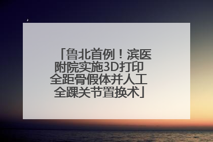 鲁北首例！滨医附院实施3D打印全距骨假体并人工全踝关节置换术